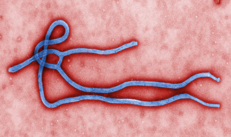 Ebola-virus