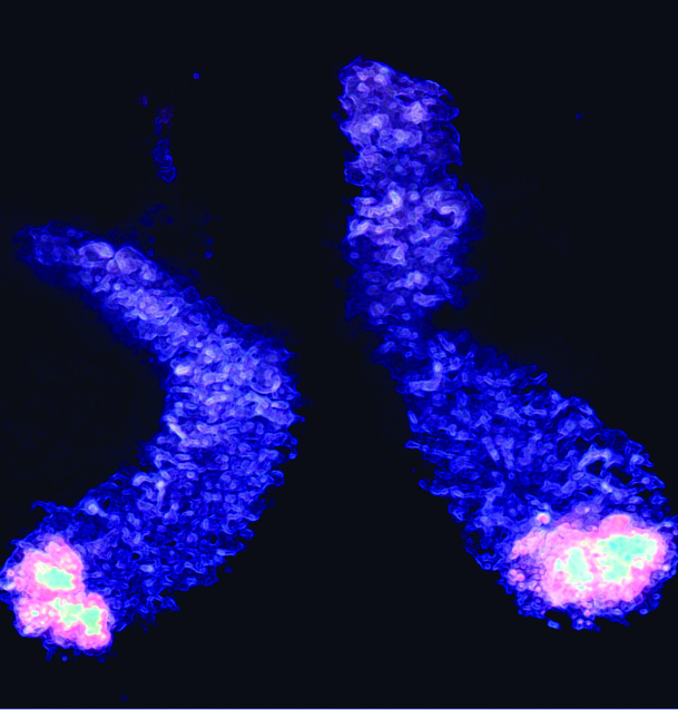 Paneth cells in the small intestine (ileum) can regulate bacterial flora by secreting anti-bacterial compounds. Photograph shows isolated mouse ileum containing Paneth cells. 