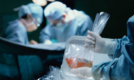 Organ transplantation