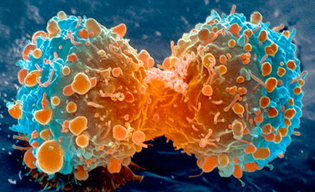 Cancer cells are characterized with uncontrolled proliferation. The immune system eliminates cancers cells using MHC class I and cytotoxic T cells.