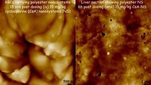 Blood and Liver sections showing particles under AFM